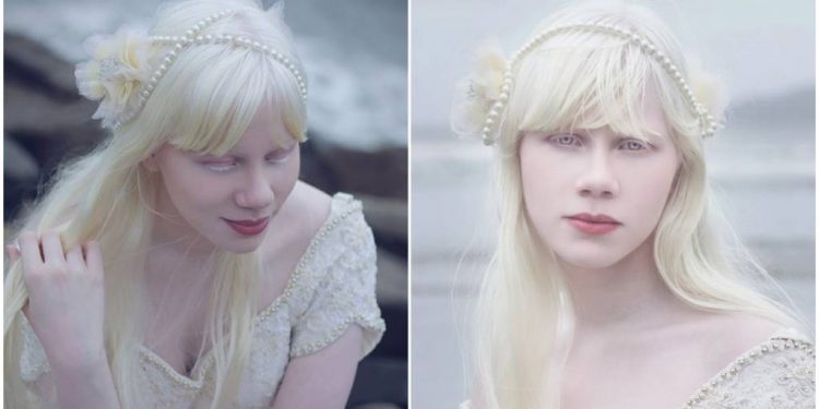 Mundo Albino mundo blanco