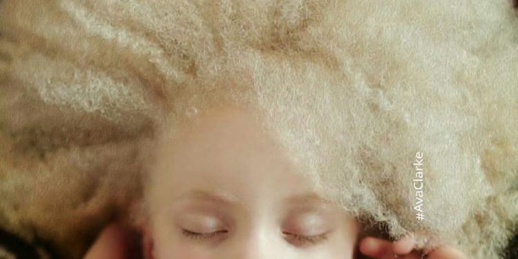 Mundo Albino mundo blanco