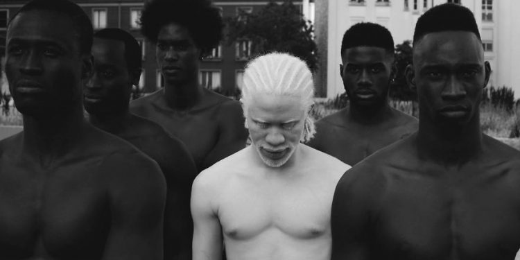 Mundo Albino mundo blanco