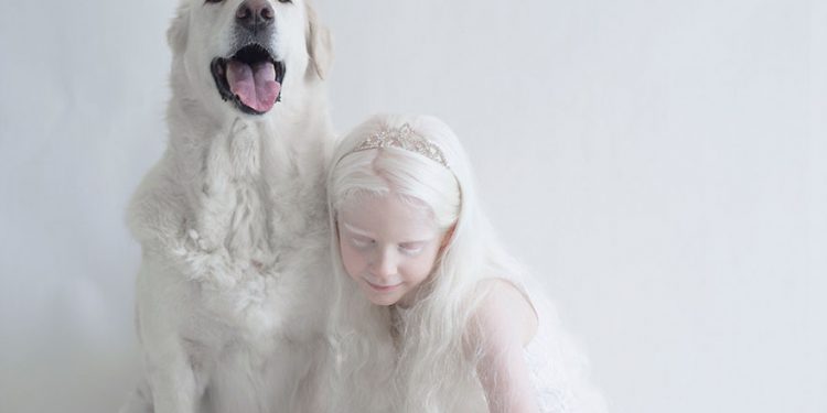 Mundo Albino mundo blanco