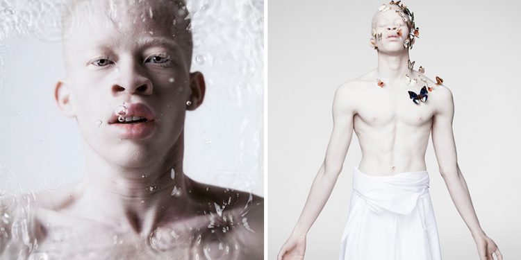 Mundo Albino mundo blanco