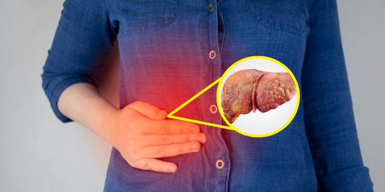 ¿Por qué se inflama el hígado y qué comer para reducir los problemas hepáticos?