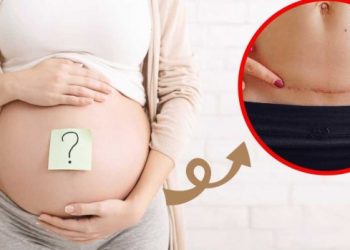 ¿Se puede tener un parto “natural” después de una cesárea?