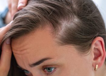 3 alimentos que devuelven la vida al cabello