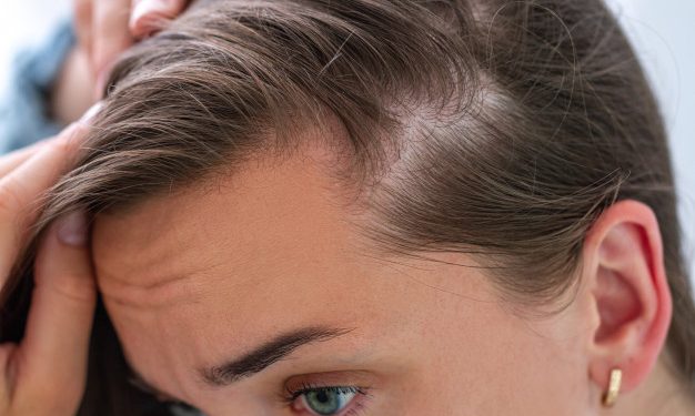 3 alimentos que devuelven la vida al cabello