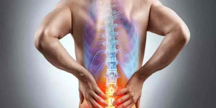 Dolor de ciática: Centro de la Columna Vertebral habla de mitos y realidades