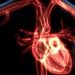 Complicaciones cardiovasculares por COVID-19 a largo plazo