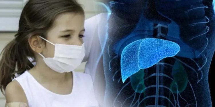 Desconocen la causa de los nuevos casos de hepatitis aguda en la niñez