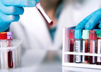 ¿Cómo interpretar los exámenes de laboratorio?