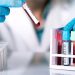 ¿Cómo interpretar los exámenes de laboratorio?