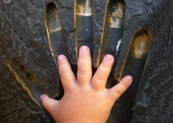 ¿Sabes qué es la acondroplasia?