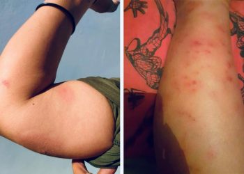 Urge fumigación en Molino de Camou por picaduras de insecto