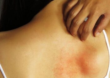 Estos son los problemas de la piel que nunca debes ignorar