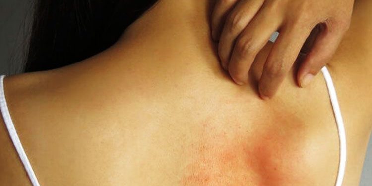 Estos son los problemas de la piel que nunca debes ignorar