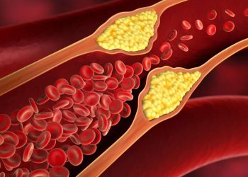 Estos alimentos representan peligro para tus arterias