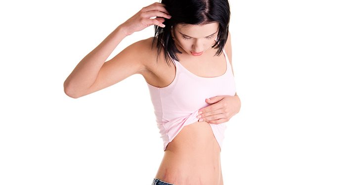 ¿Pueden aparecer estrías en la adolescencia?