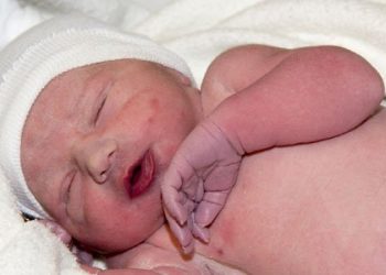Bebés que nacen morado o se ponen morados